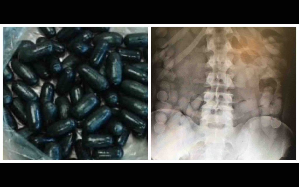 capsules drogue estomac radio avaler mule cannabis cocaïne