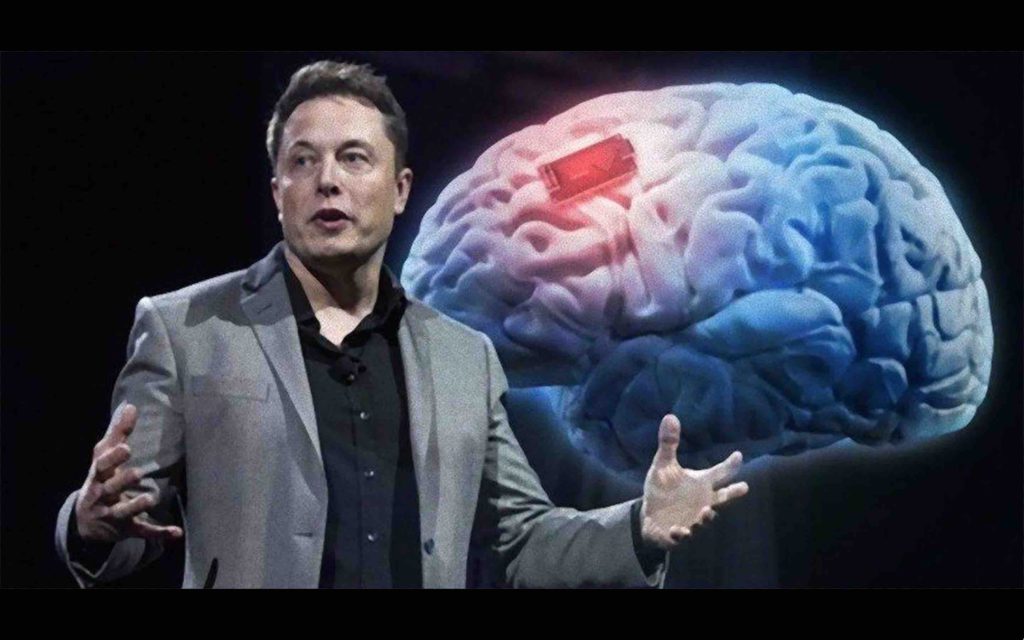 Neuralink va tester ses implants cérébraux sur des humains