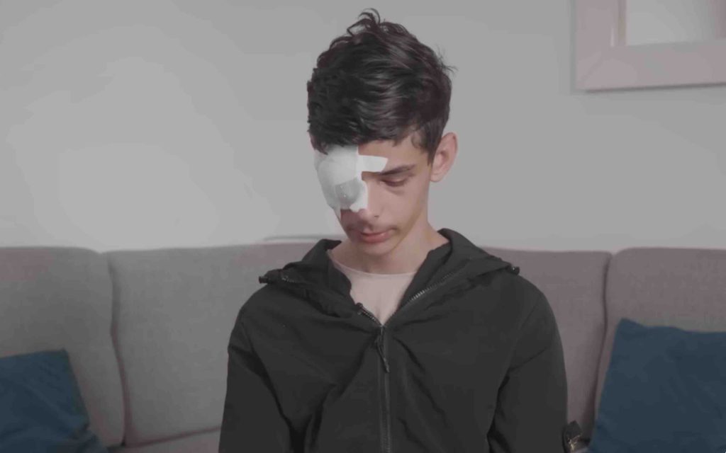 (Vidéo) France - Jalil, 15 ans, éborgné par la police