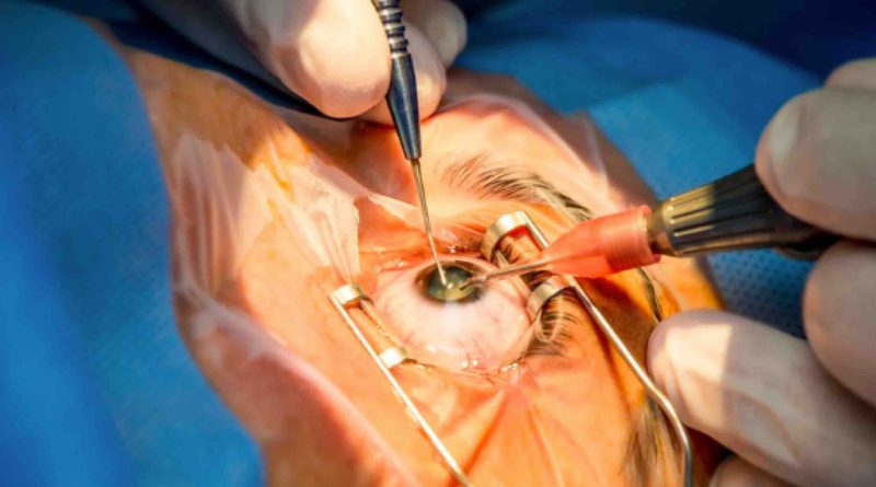 Opération oeil cataracte Maroc infirmier