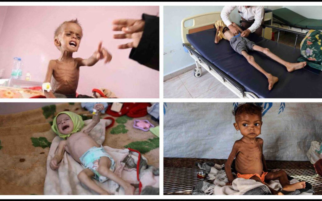 ONU Organisation des Nations unies malnutrition